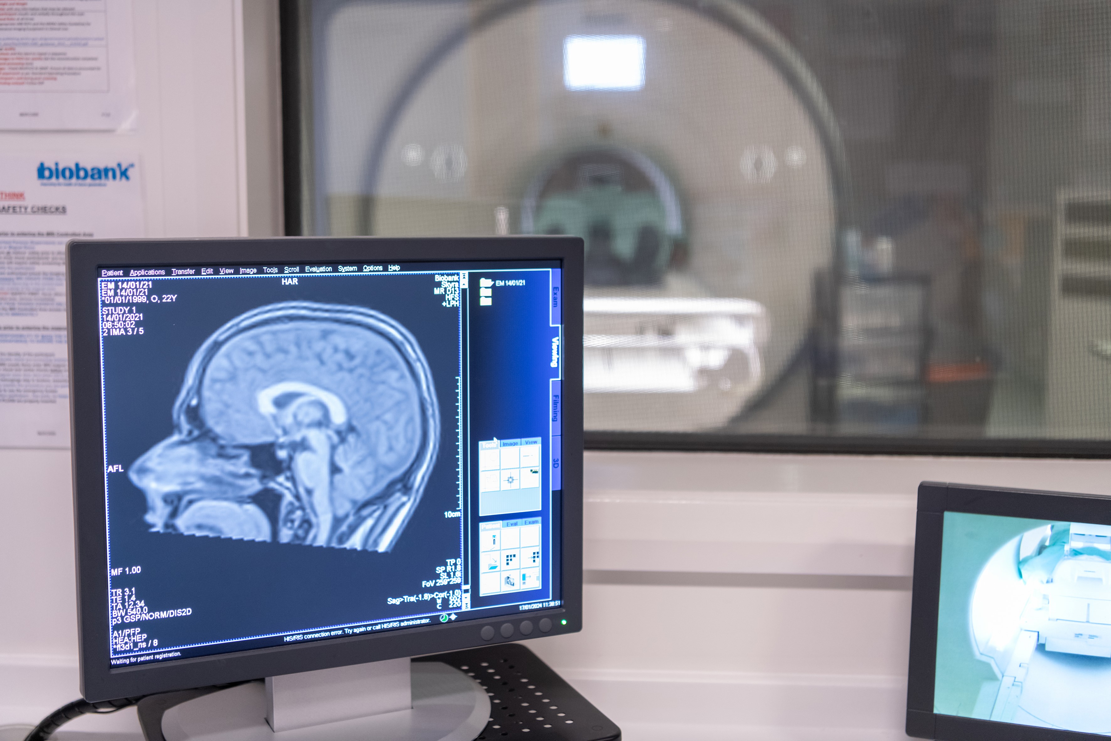 MRI brain scan of a UK Biobank participant
