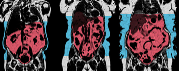 MRI scans of internal organs