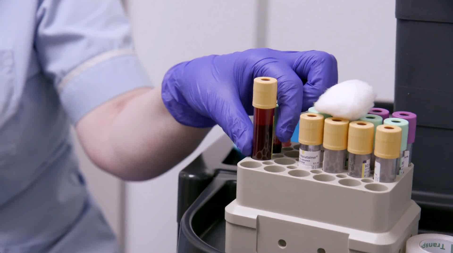A vial of blood, next to other test tubes, being held by a nurse's gloved hand