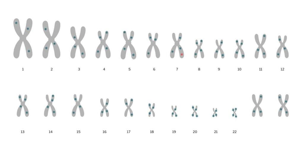 A depiction of the 23 human chromosomes. Variants are shown as many blue stars on these chromosomes. One star is red, highlighting the variant that causes cystic fibrosis.